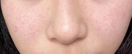 「写真のような赤いポツポツはなんなのでしょ」の質問画像
