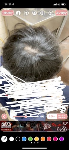 「禿げてますか？」の質問画像