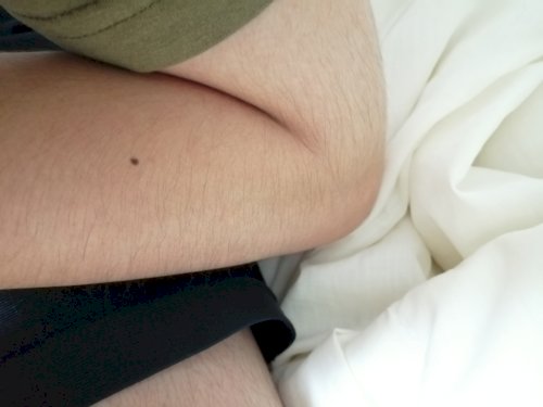 「男子大学生です。このレベルの腕毛？ってそ」の補足画像1