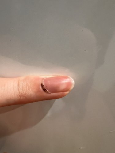 「爪のこれって何なんでしょうか？ もう何年」の質問画像