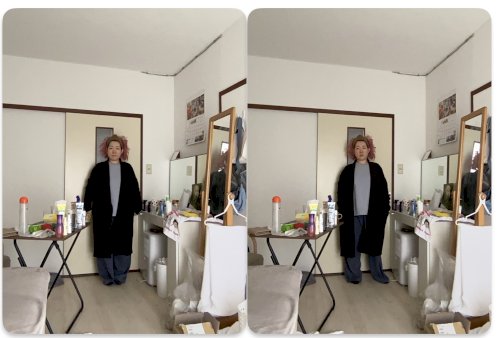 「痩せたら老けると思いますか？ びんちょの」の質問画像