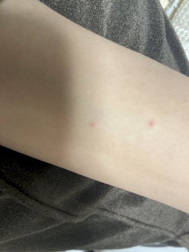 「腕によく赤い傷跡がある。」の質問画像