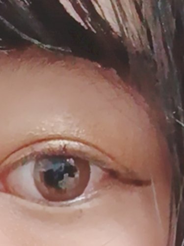 「ぱっちり二重ですか？」の質問画像