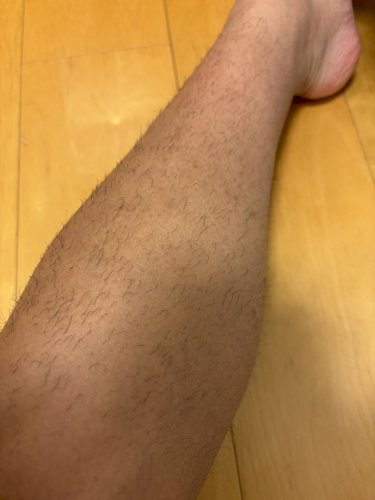 「すね毛がこんな感じで濃くてボリュームがあ」の質問画像